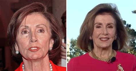 pelosi boobs|Plastic Surgeons Weigh In On Nancy Pelosis Tight, Shiny New。